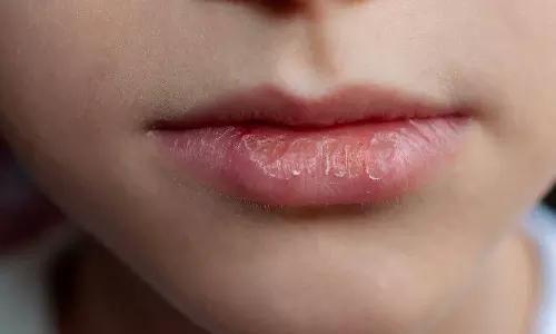 ചുണ്ടുകള്‍ വരണ്ടുപൊട്ടുന്നത് തണുപ്പുകൊണ്ട് മാത്രമല്ല; ഗുരുതരമായ ആരോഗ്യ പ്രശ്നങ്ങളുടെ സൂചനയാകാം