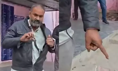 കടിച്ച പാമ്പിനെ പോക്കറ്റിലിട്ട് യുവാവ് ആശുപത്രിയിൽ; അരമണിക്കൂറിന് ശേഷം സംഭവിച്ചത്‌ ഇങ്ങനെ