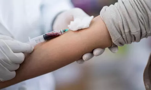 blood test, 8 Health Screenings You Should Get This Year If Youre 30 And Above