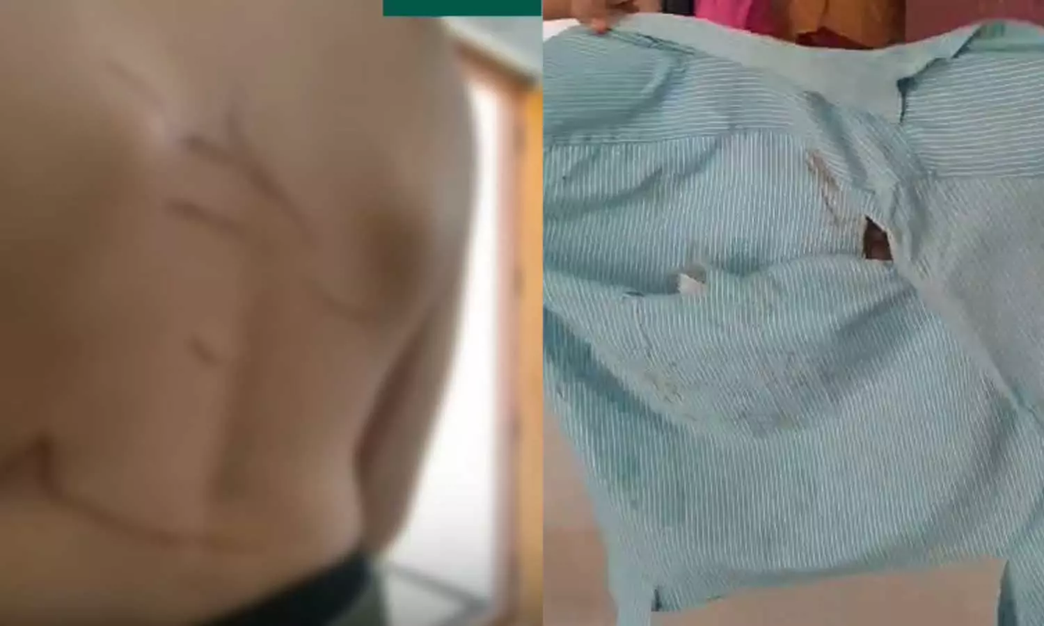 മുള്ളുവേലിയില് കിടത്തി ചവിട്ടി; വയനാട് കണിയാമ്പറ്റയില് 14കാരന് ക്രൂരമര്ദനം മുള്ളുവേലിയില് കിടത്തി ചവിട്ടി; വയനാട് കണിയാമ്പറ്റയില് 14കാരന് ക്രൂരമര്ദനം