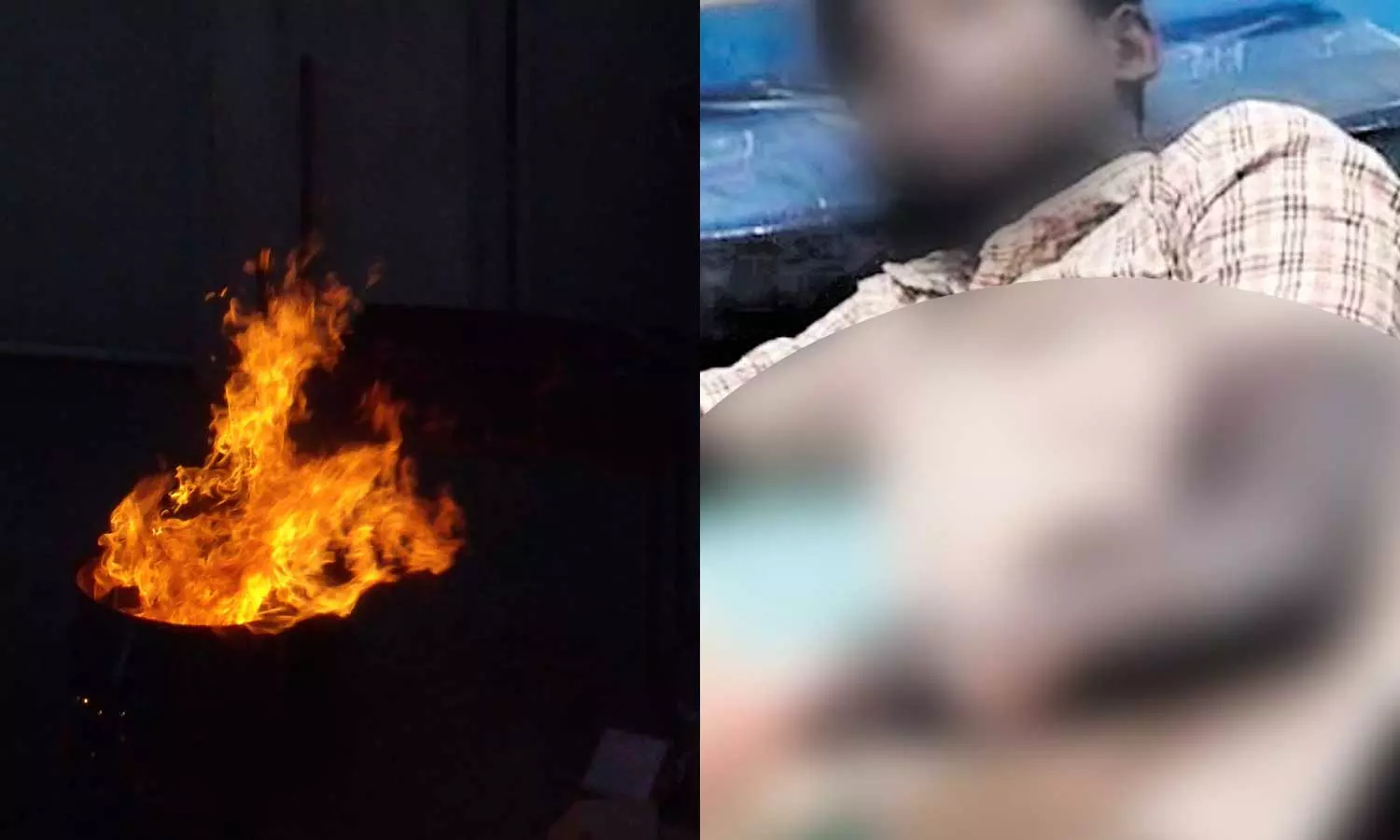 SC boy flung into burning waste pit by classmates SC boy flung into burning waste pit by classmates