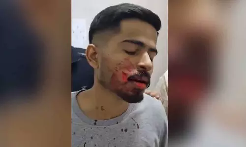 ഭീകരാന്തരീക്ഷം സൃഷ്ടിച്ച് അക്രമി; റഷ്യയിൽ നാല് ഇന്ത്യൻ മെഡിക്കൽ വിദ്യാർഥികൾക്ക് കുത്തേറ്റു