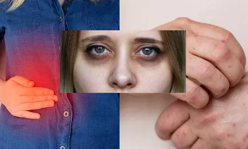 ഫാറ്റി ലിവറുണ്ടോ?; ചർമ്മം നൽകുന്ന ഈ സൂചനകൾ അവഗണിക്കരുത്, ജീവന് ഭീഷണിയാകാം!