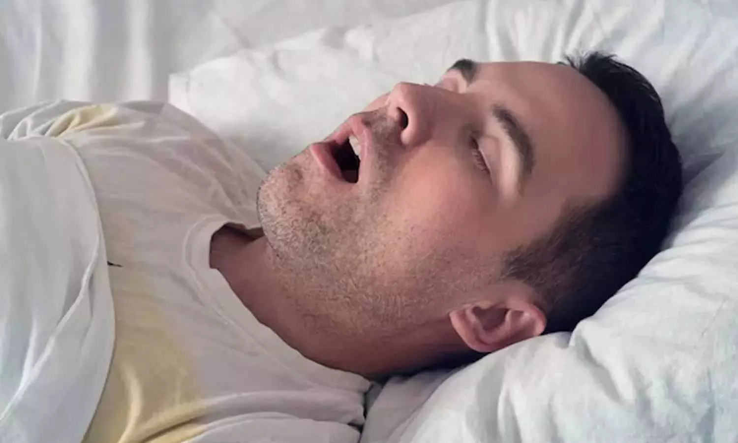 കൂർക്കംവലി അത്ര നിസാരമല്ല; കാരണമറിഞ്ഞ് പരിഹരിക്കാം കൂർക്കംവലി അത്ര നിസാരമല്ല; കാരണമറിഞ്ഞ് പരിഹരിക്കാം