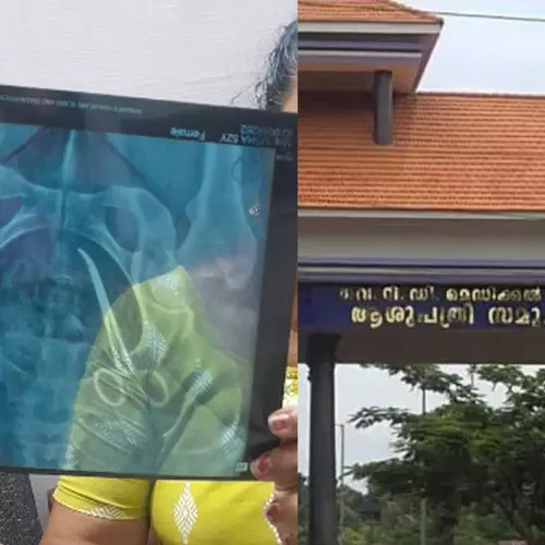 വണ്ടാനം മെഡിക്കൽ കോളജിൽ ശസ്ത്രക്രിയക്കിടെ വയോധികയുടെ വയറ്റില് കത്രിക കുടുങ്ങി