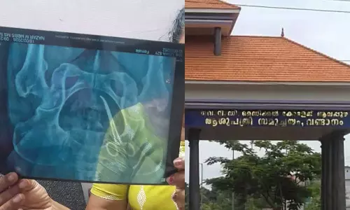ശസ്ത്രക്രിയക്ക് പിന്നാലെ തുടര്‍ച്ചയായി വയറുവേദന; സ്‌കാനിങ്ങില്‍ വയോധികയുടെ വയറ്റില്‍ കത്രിക; നിയമനടപടിക്കൊരുങ്ങി കുടുംബം