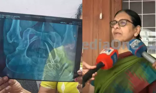 20 വര്‍ഷം കത്രിക വയറ്റില്‍ കിടന്നാലും അറിയണമെന്നില്ല, ശസ്ത്രക്രിയ നടത്തിയത് ഓര്‍മയിലില്ല: വിചിത്രവാദവുമായി ഡോ.ലളിതാംബിക