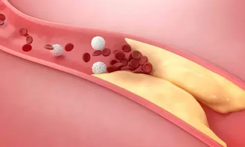 കൊളസ്ട്രോൾ കുറയ്ക്കാനും ഹൃദയാരോഗ്യം വർദ്ധിപ്പിക്കാനും സഹായിക്കുന്ന നാല് ഭക്ഷണങ്ങൾ ഇവയാണ്