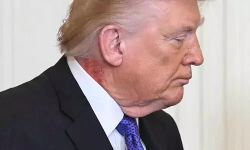 Donald Trump appears with red rash on neck Donald Trump appears with red rash on neck