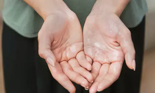 കൈകൾ എപ്പോഴും വിയർക്കുന്നുണ്ടോ?; ശരീരം നൽകുന്ന മുന്നറിയിപ്പുകള്‍ അവഗണിക്കരുത്