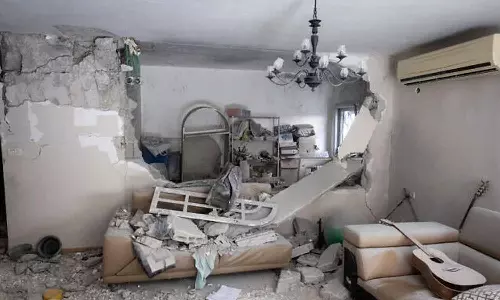 ഇറാന്റെ തിരിച്ചടി; ഇസ്രായേലില്‍ 24  മണിക്കൂറിനിടെ 70 പേർ ആശുപത്രിയില്‍, കണക്കുകള്‍ ഇങ്ങനെ...