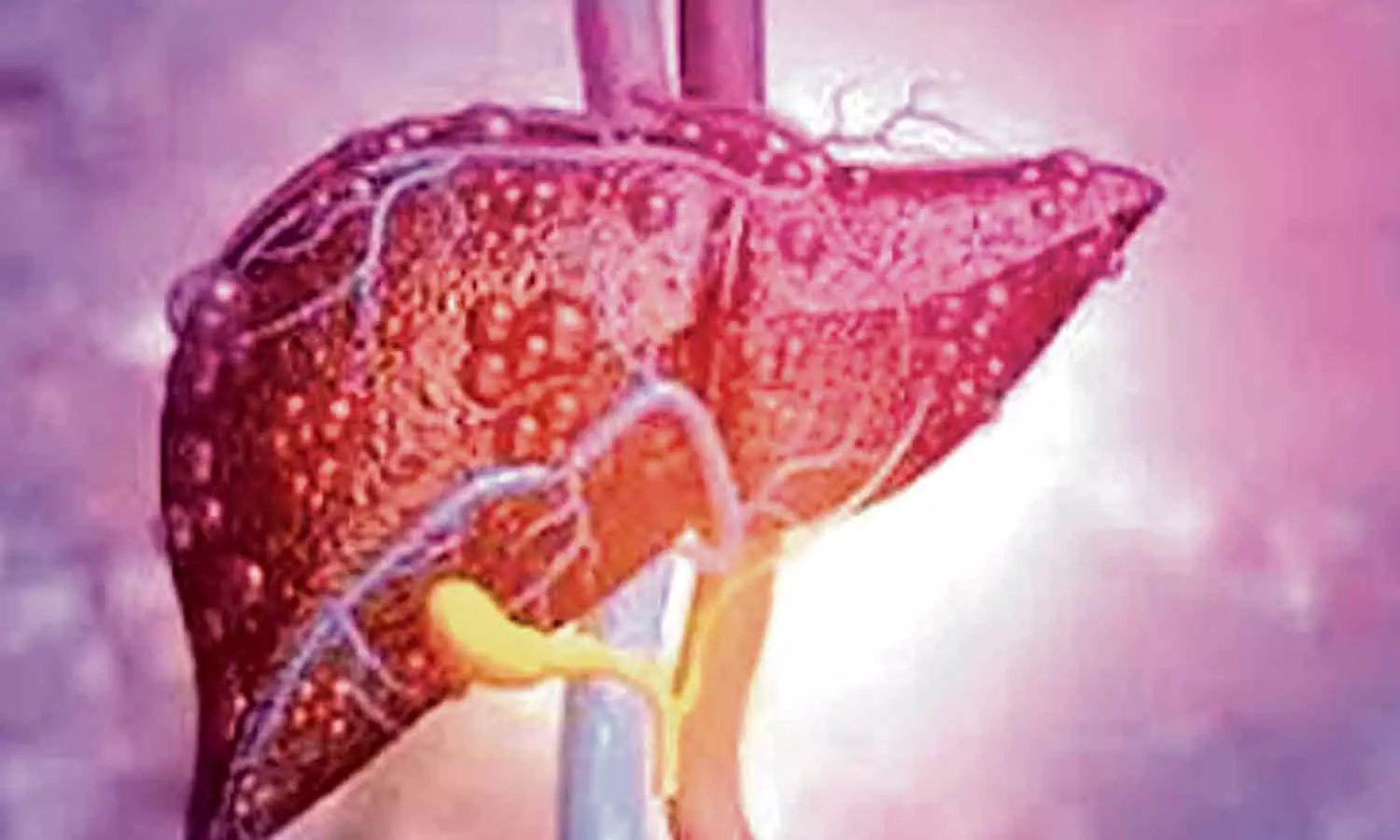 ഉറക്കകുറവ് ഫാറ്റി ലിവറിന് കാരണമാവുമോ ?; ഉറക്കവും കരളും തമ്മിലുള്ള ബന്ധമെന്ത് ? ഉറക്കകുറവ് ഫാറ്റി ലിവറിന് കാരണമാവുമോ ?; ഉറക്കവും കരളും തമ്മിലുള്ള ബന്ധമെന്ത് ?