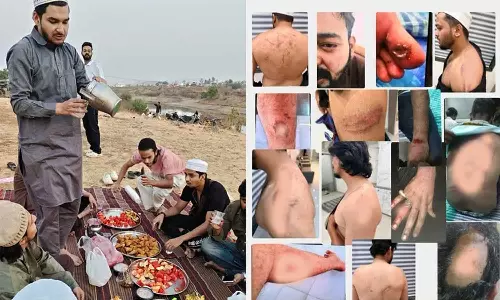 മുസ്ലിംകൾ ഇവിടെ ഇരിക്കരുതെന്ന് പറഞ്ഞു, വസ്ത്രങ്ങൾ കീറി, അടിച്ചു; പൂനെയിൽ ഇഫ്താർ വിരുന്ന് നടത്തിയവർക്ക് ക്രൂരമർദനം മുസ്ലിംകൾ ഇവിടെ ഇരിക്കരുതെന്ന് പറഞ്ഞു, വസ്ത്രങ്ങൾ കീറി, അടിച്ചു; പൂനെയിൽ ഇഫ്താർ വിരുന്ന് നടത്തിയവർക്ക് ക്രൂരമർദനം