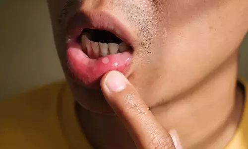 വിട്ടുമാറാത്ത വായ്പുണ്ണും വായ്നാറ്റവുമുണ്ടോ? ഈ ലക്ഷണങ്ങൾ അവ​ഗണിക്കരുത്