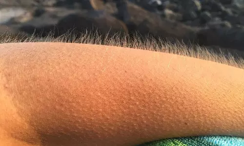 രോമാഞ്ചമുണ്ടാകുന്നതിന് പിന്നിലെ രഹസ്യമിതാണ്...