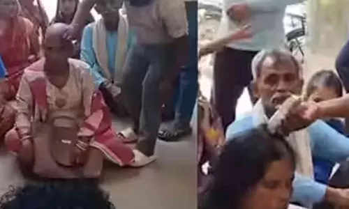 വികസനത്തിൽ വിവേചനം; ബിജെപി ഭരിക്കുന്ന കോർപ്പറേഷന് മുന്നിൽ തല മൊട്ടയടിച്ച് ബിജെപി വനിത കൗൺസിലറുടെ പ്രതിഷേധം