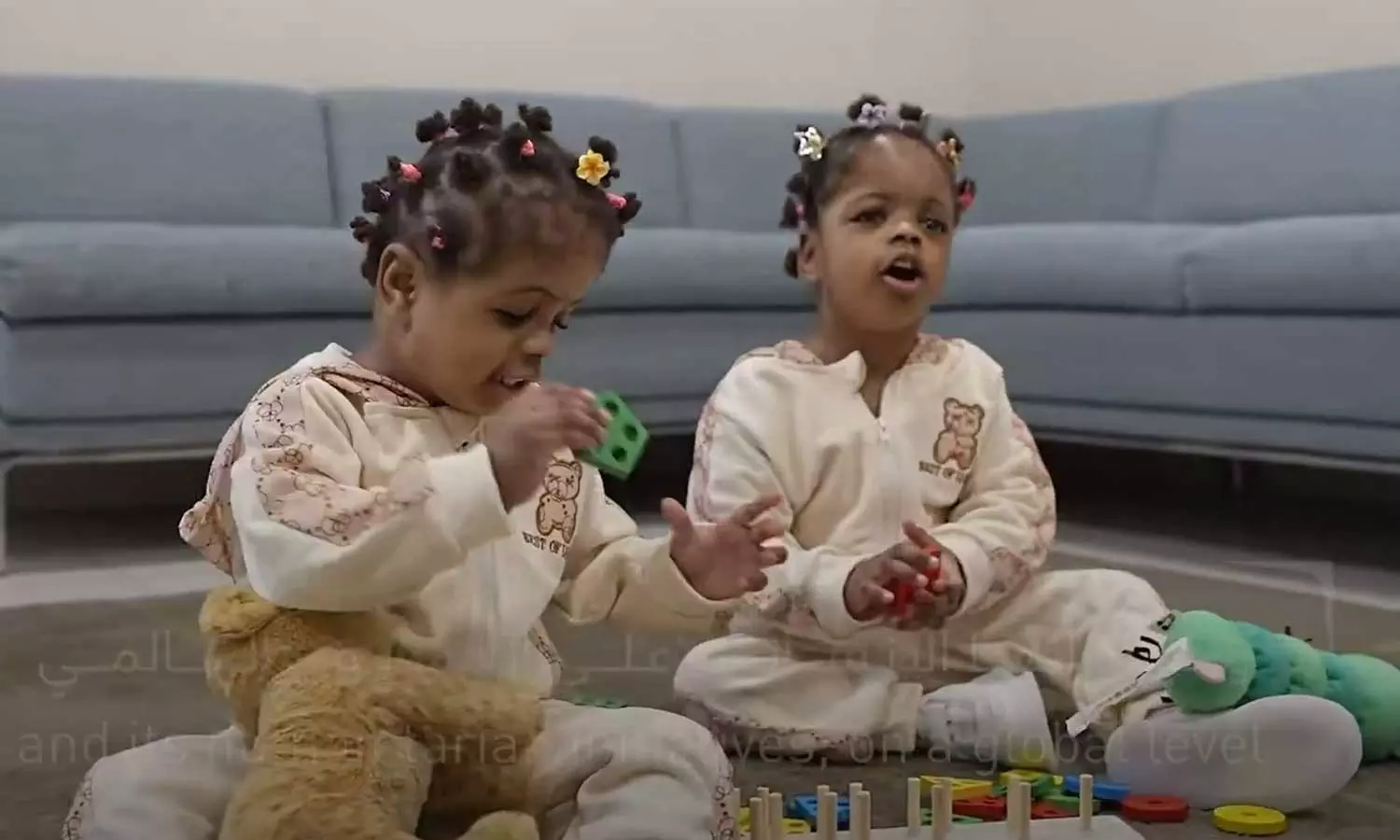 Conjoined twins separated from each other; Mercy and Jelsy given new life in Abu Dhabi Conjoined twins separated from each other; Mercy and Jelsy given new life in Abu Dhabi