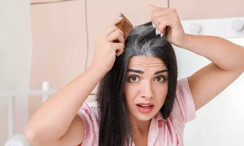 ഡൈ പുരട്ടി സമയം കളയണ്ട; ഈ ട്രിക്ക് ഒന്ന് പരീക്ഷിച്ചു നോക്കൂ ഡൈ പുരട്ടി സമയം കളയണ്ട; ഈ ട്രിക്ക് ഒന്ന് പരീക്ഷിച്ചു നോക്കൂ