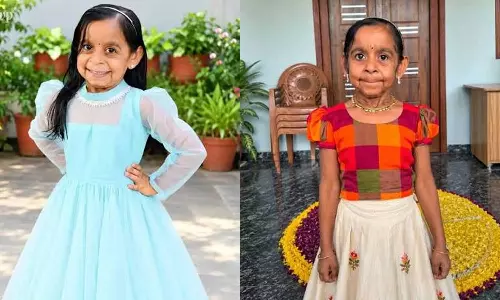 50 വർഷത്തിന് ശേഷം ആദ്യം; അപൂർവ രോഗാവസ്ഥയുമായി ആറുവയസ്സുകാരി തക്കു! എന്താണ് ക്യൂട്ടിസ് ലാക്സ? 50 വർഷത്തിന് ശേഷം ആദ്യം; അപൂർവ രോഗാവസ്ഥയുമായി ആറുവയസ്സുകാരി തക്കു! എന്താണ് ക്യൂട്ടിസ് ലാക്സ?