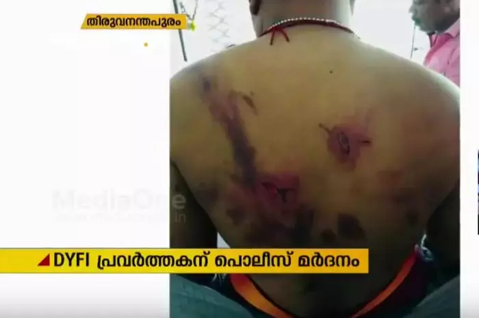 തിരുവനന്തപുരത്ത് ഡിവൈഎഫ്ഐ പ്രവര്‍ത്തകന് പൊലീസിന്‍റെ ക്രൂരമര്‍ദനം