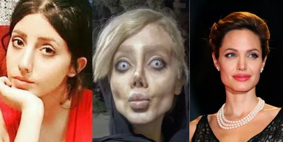 ആഞ്ചലീന ജോളിയാകാന്‍ 50 ശസ്ത്രക്രിയകള്‍! സത്യമിതാണ്..