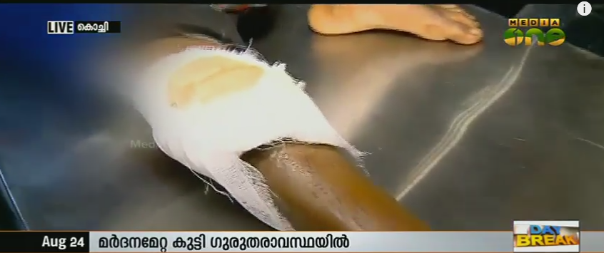 അമ്മയുടെ ക്രൂരമര്‍ദനമേറ്റ 9 വയസുകാരന്‍ ഗുരുതരാവസ്ഥയില്‍