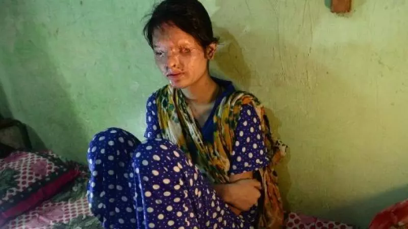 ചങ്കൂറ്റമാണ് ഇവളുടെ സൌന്ദര്യം, ക്യാറ്റ് വാക്കിനൊരുങ്ങി ആസിഡ് ആക്രമണത്തിലെ ഇര ചങ്കൂറ്റമാണ് ഇവളുടെ സൌന്ദര്യം, ക്യാറ്റ് വാക്കിനൊരുങ്ങി ആസിഡ് ആക്രമണത്തിലെ ഇര