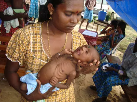 അട്ടപ്പാടിയിലെ ശിശുമരണം; പുതിയകാരണങ്ങള്‍ കണ്ടെത്തി ആരോഗ്യവകുപ്പ്