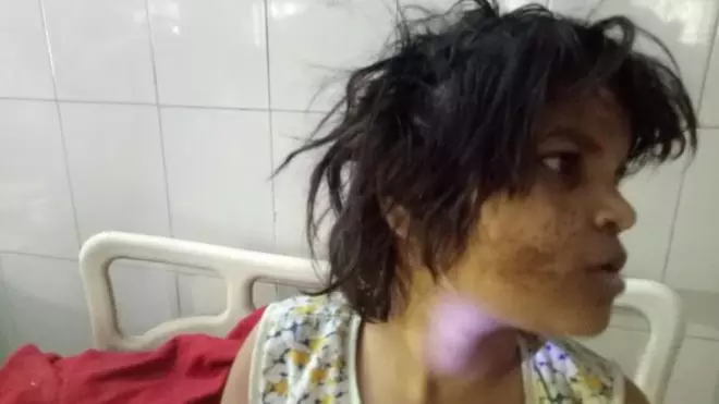 വന്യജീവിസങ്കേതത്തില് കുരങ്ങുകള്ക്കൊപ്പം ജീവിച്ചിരുന്ന പെണ്കുട്ടിയെ രക്ഷിച്ചു വന്യജീവിസങ്കേതത്തില് കുരങ്ങുകള്ക്കൊപ്പം ജീവിച്ചിരുന്ന പെണ്കുട്ടിയെ രക്ഷിച്ചു