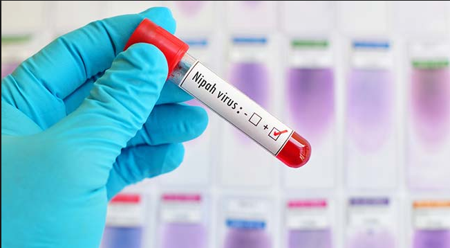 നിപാ വൈറസിന്റെ ഉറവിടം ; അന്വേഷണം ഊര്‍ജ്ജിതം