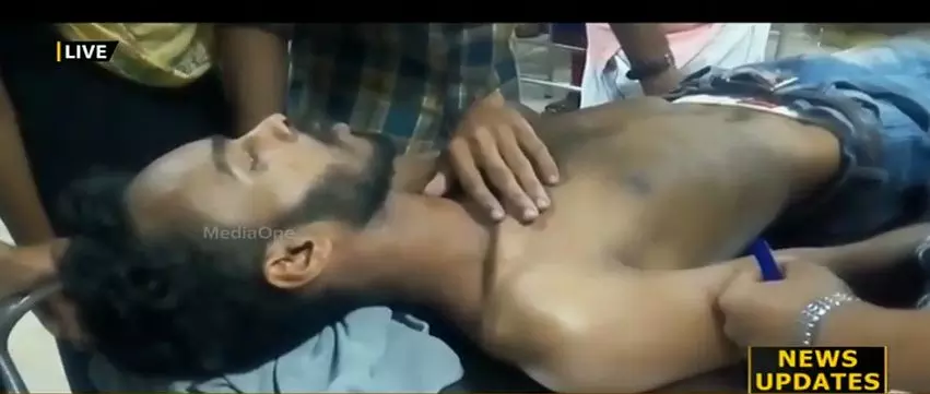 കോഴിക്കോട് ലോ കോളജില്‍ എസ്എഫ്ഐ പ്രവര്‍ത്തകര്‍ വിദ്യാര്‍ഥിയെ മര്‍ദ്ദിച്ചെന്ന് പരാതി