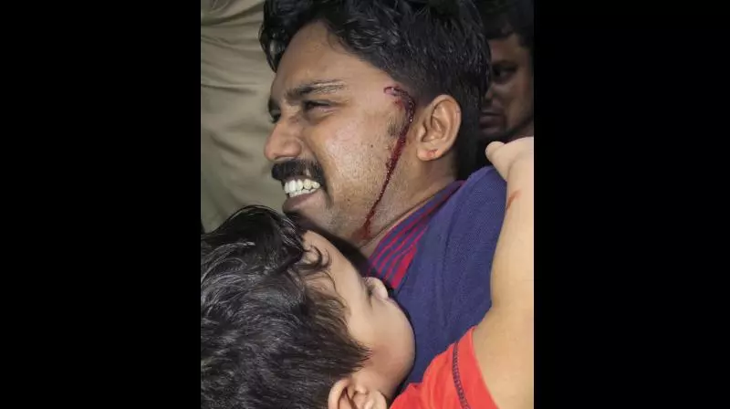 പൊലീസ് അക്രമത്തില്‍ പരിക്കേറ്റ സന്തോഷ് ഫെലിക്‌സിന്റെ നില ഗുരുതരമായി തുടരുന്നു