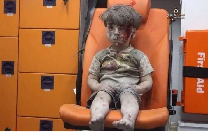 സിറിയന്‍ ദുര്‍വിധിയുടെ നേര്‍സാക്ഷ്യമാണ് ഈ അഞ്ച് വയസുകാരന്റെ ചിത്രം