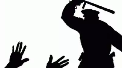 ക്ഷേത്രോത്സവത്തിനിടെ സംഘര്ഷം: പിടികൂടിയ നിരപരാധികള്ക്ക് പൊലീസിന്റെ ക്രൂരമര്ദ്ദനം ക്ഷേത്രോത്സവത്തിനിടെ സംഘര്ഷം: പിടികൂടിയ നിരപരാധികള്ക്ക് പൊലീസിന്റെ ക്രൂരമര്ദ്ദനം