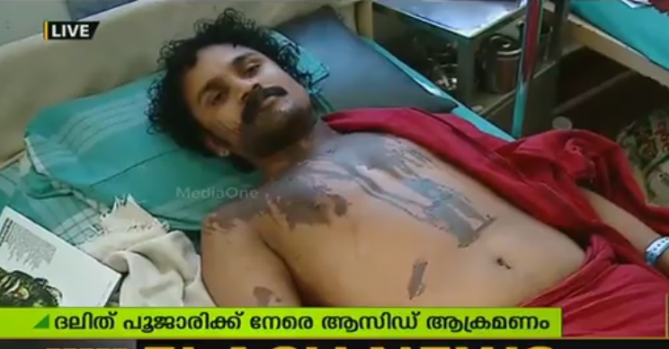 പട്ടാമ്പിയില്‍ ദലിത് പൂജാരിക്ക് നേരെ ആസിഡ് ആക്രമണം