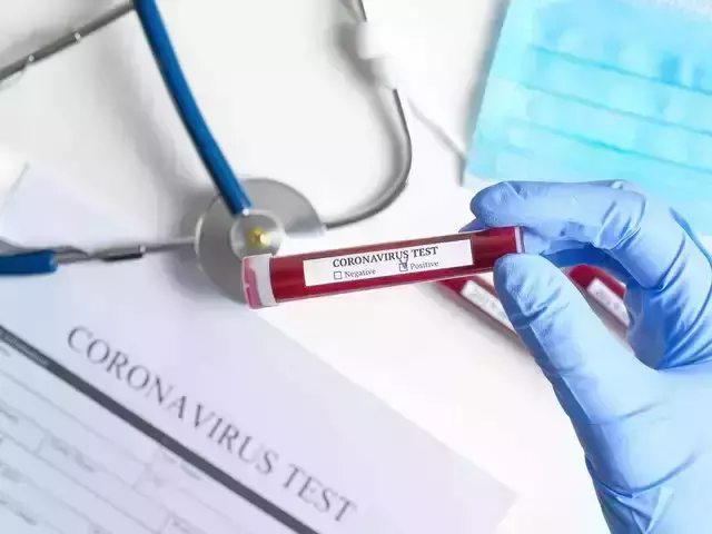 പ്രവാസികള്‍ക്ക് യു.എ.ഇയിലേക്ക് മടങ്ങാന്‍ കോവിഡ് പരിശോധന; കേരളത്തിൽ 22 ലാബുകളിൽ സൗകര്യം