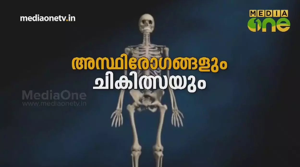 അസ്ഥിരോഗങ്ങളും ചികിത്സയും | Stethoscope (Episode 224)  