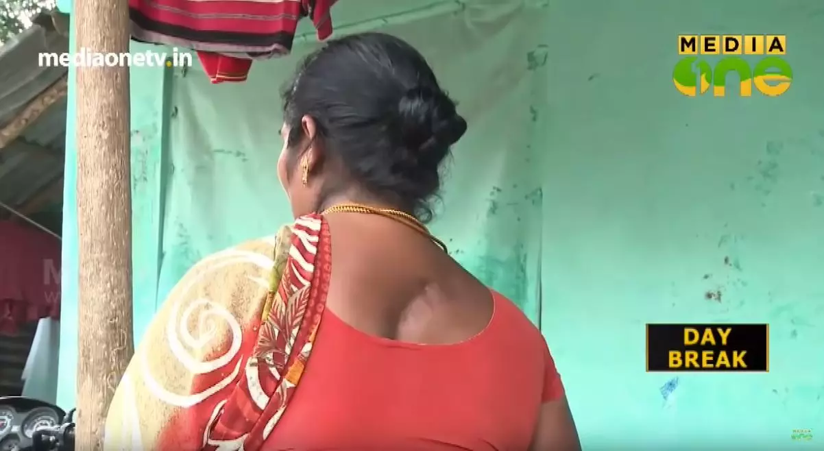 കാട്ടാനകളുടെ ആക്രമണങ്ങളില്‍ നിന്ന് തലനാരിഴക്ക് രക്ഷപ്പെട്ടവരുടെ ദുരിത ജീവിതം