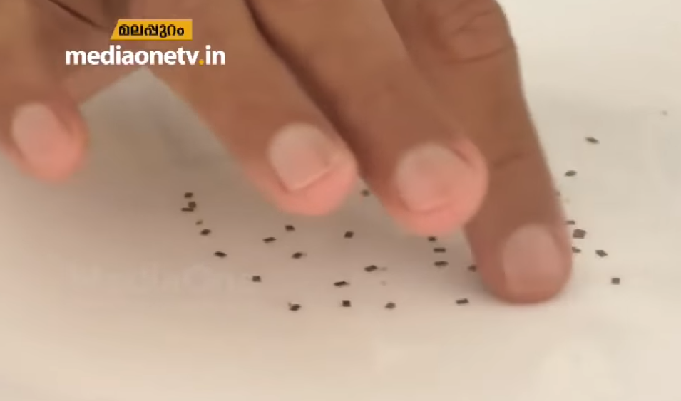 വായില്‍ നിന്നും ലോഹച്ചീളുകള്‍; വിശദീകരിക്കാനാവാതെ ഡോക്ടര്‍മാര്‍ 