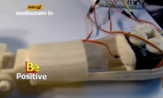 കൈകള്‍ ഇല്ലാത്തവര്‍ക്ക് പ്രതീക്ഷയേകി ഒരു കൂട്ടം വിദ്യാര്‍ഥികള്‍; ഇത് ചിന്തിക്കുന്ന പോലെ പ്രവര്‍ത്തിക്കുന്ന ‘ബയോണിക് ആം’