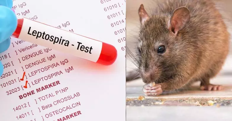 എലിപ്പനി: മനുഷ്യർക്ക് അണുബാധ ഉണ്ടാകുന്നത് എങ്ങനെ എലിപ്പനി: മനുഷ്യർക്ക് അണുബാധ ഉണ്ടാകുന്നത് എങ്ങനെ