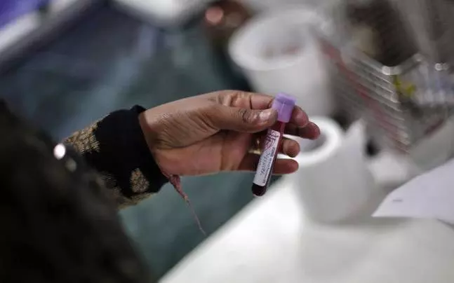 സംസ്ഥാനത്ത് കോംഗോ പനി സ്ഥിരീകരിച്ചു സംസ്ഥാനത്ത് കോംഗോ പനി സ്ഥിരീകരിച്ചു