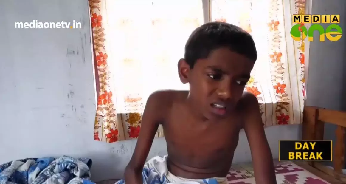 അപൂര്‍വ്വ രോഗം പിടിപ്പെട്ട നിഖില്‍ ചികിത്സസഹായം തേടുന്നു