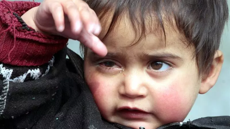 കാശ്മീരില് സൈന്യത്തിന്റെ പെല്ലറ്റേറ്റ കുഞ്ഞു ഹിബയുടെ കാഴ്ച്ച പൂര്ണമായും നഷ്ടപ്പെടും കാശ്മീരില് സൈന്യത്തിന്റെ പെല്ലറ്റേറ്റ കുഞ്ഞു ഹിബയുടെ കാഴ്ച്ച പൂര്ണമായും നഷ്ടപ്പെടും