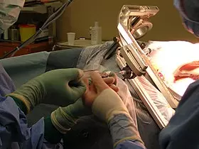 എന്താണ്, എന്തിനാണ് ബയോപ്സി? എന്താണ്, എന്തിനാണ് ബയോപ്സി?