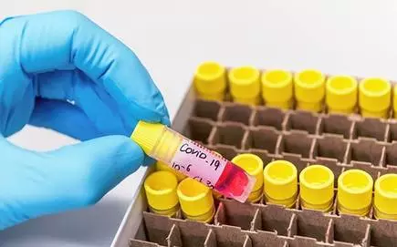 എറണാകുളത്ത് ആരോഗ്യപ്രവര്ത്തകന് കോവിഡ് ബാധിച്ചത് പ്രതിരോധ പ്രവര്ത്തനങ്ങള്ക്കിടെ; ആരോഗ്യനില തൃപ്തികരം എറണാകുളത്ത് ആരോഗ്യപ്രവര്ത്തകന് കോവിഡ് ബാധിച്ചത് പ്രതിരോധ പ്രവര്ത്തനങ്ങള്ക്കിടെ; ആരോഗ്യനില തൃപ്തികരം