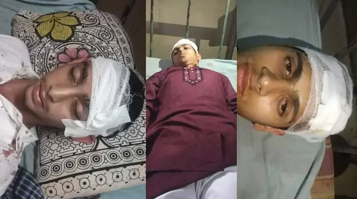 ‘ജയ് ശ്രീറാം’: ഗുജറാത്തിൽ മൂന്ന് മദ്രസാ വിദ്യാർത്ഥികളെ ആക്രമിച്ചു; കേസെടുക്കാതെ പൊലീസ് ‘ജയ് ശ്രീറാം’: ഗുജറാത്തിൽ മൂന്ന് മദ്രസാ വിദ്യാർത്ഥികളെ ആക്രമിച്ചു; കേസെടുക്കാതെ പൊലീസ്