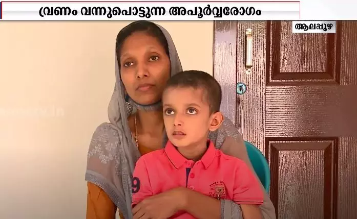 യാസീന്റെ ദുരിതം മീഡിയവണ് സ്നേഹസ്പര്ശത്തിലൂടെ അറിഞ്ഞ് സുമനസ്സുകളുടെ സഹായം യാസീന്റെ ദുരിതം മീഡിയവണ് സ്നേഹസ്പര്ശത്തിലൂടെ അറിഞ്ഞ് സുമനസ്സുകളുടെ സഹായം