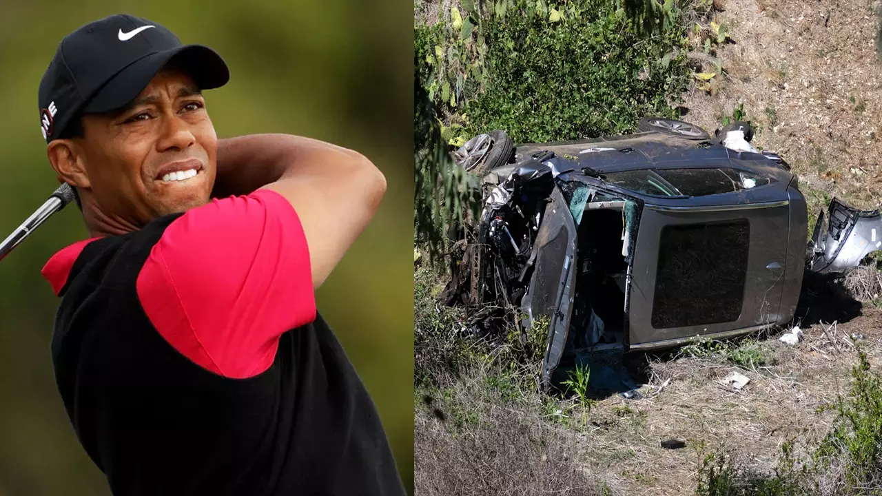ഗോള്ഫ് താരം ടൈഗര് വുഡ്സിന് കാറപകടത്തില് ഗുരുതര പരിക്ക് ഗോള്ഫ് താരം ടൈഗര് വുഡ്സിന് കാറപകടത്തില് ഗുരുതര പരിക്ക്