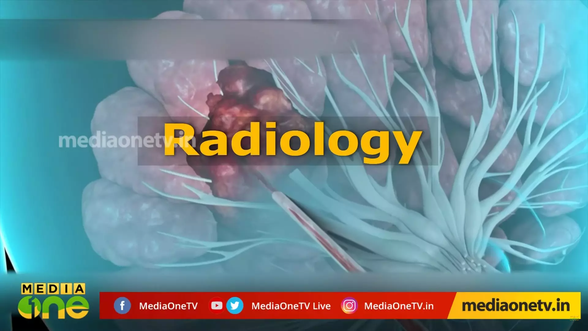 റേഡിയോളജി|Stethoscope